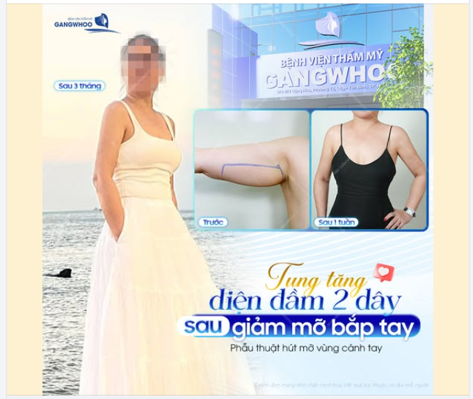 TUNG TĂNG DIỆN ĐẦM 2 DÂY