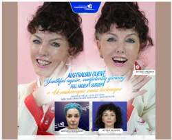 Không chỉ là làm đẹp, Mrs. J cảm nhận rõ ràng sự thay đổi về tinh thần: trẻ trung, tự tin, tràn đầy năng lượng trong các hoạt động hàng ngày.