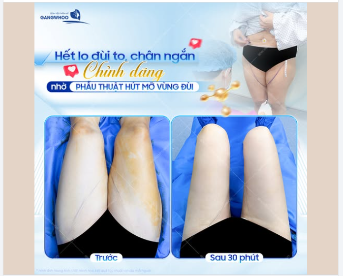 ĐÙI GỌN GÀNG – VÓC DÁNG HÀI HÒA