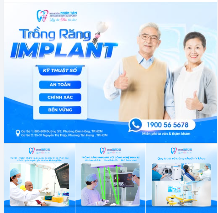 TRỒNG RĂNG IMPLANT KỸ THUẬT SỐ  AN TOÀN – CHÍNH XÁC – BỀN VỮNG