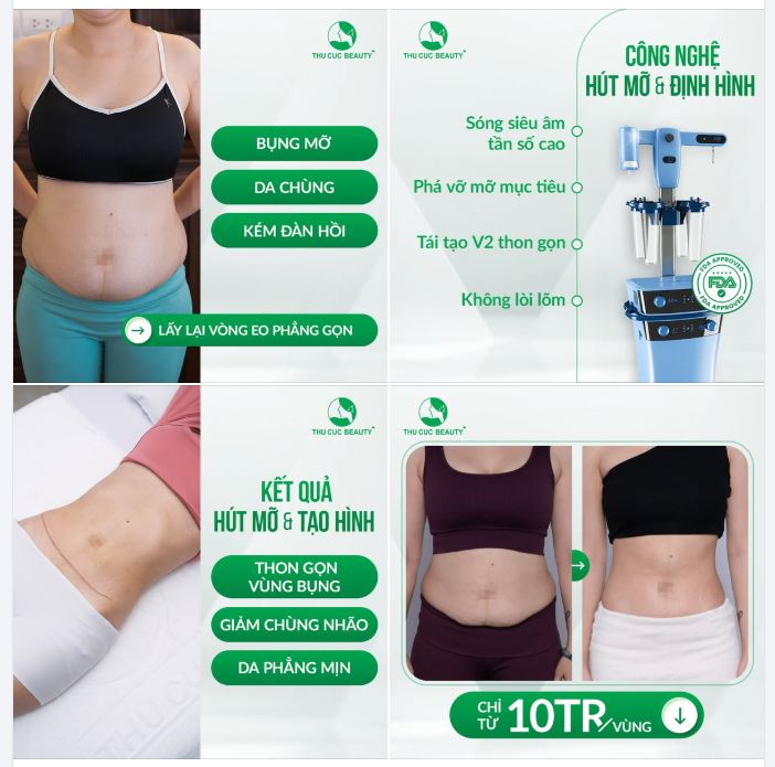 TẠM BIỆT BỤNG MỠ - DA CHÙNG TỰ TIN ĐÓN ĐẠI LỄ