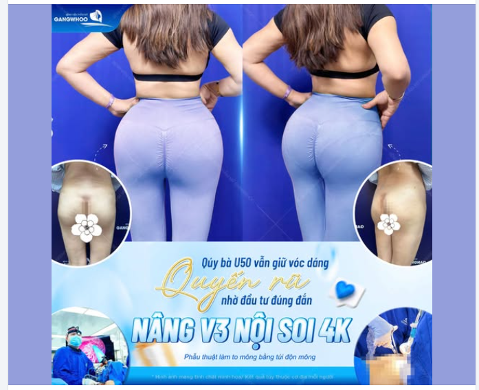 U50 HỒI XUÂN VÓC DÁNG – VÒNG 3 S-LINE QUYẾN RŨ NHƯ TUỔI ĐÔI MƯƠI