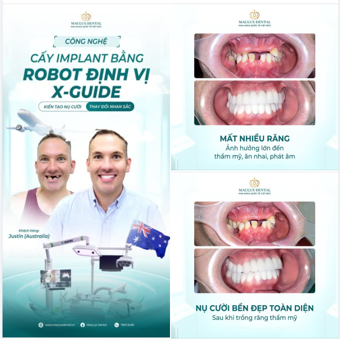 TỰ TIN TRỞ LẠI VỚI VỊ KHÁCH ĐẾN TỪ AUSTRALIA CHỈ SAU 2 TUẦN GẶP DR. MẬU