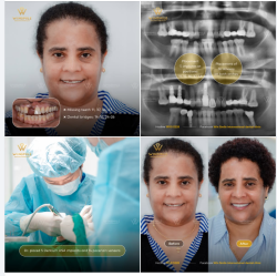 HÀNH TRÌNH 8 THÁNG TRỞ LẠI ĐỂ HOÀN THÀNH NỤ CƯỜI THẬT SỰ TỰ TIN