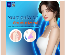 Trong quá trình phát triển tự nhiên, hình dáng vòng ngực có thể thay đổi theo từng giai đoạn.