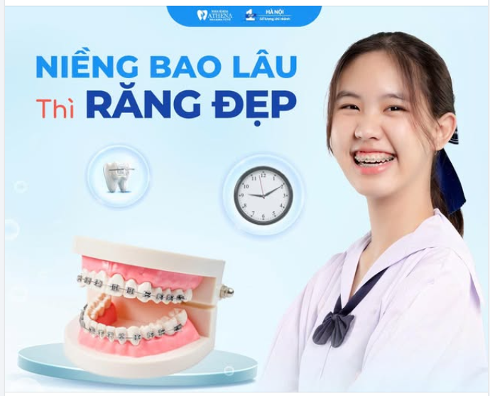 Niềng răng bao lâu thì bắt đầu thấy đẹp?  Đây là câu hỏi mà hầu như ai chuẩn bị niềng cũng quan tâm