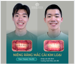 KHÔNG CHỈ LÀ NỤ CƯỜI - MÀ CÒN LÀ SỨC KHỎE ĐƯỢC CẢI THIỆN