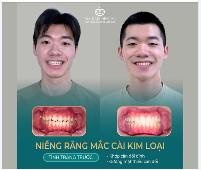 KHÔNG CHỈ LÀ NỤ CƯỜI - MÀ CÒN LÀ SỨC KHỎE ĐƯỢC CẢI THIỆN