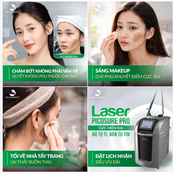 Vết chàm bớt bẩm sinh khiến bạn tự ti?  Picosure Pro chính là giải pháp "vàng" cho làn da không tì vết
