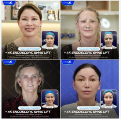 Có những nỗi lo không tên mang tên "vết chân chim" hay "cơ mặt chùng nhão". Phụ nữ hiện đại không sợ già, chỉ sợ mình không còn rạng rỡ.