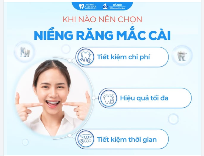 KHI NÀO BẠN NÊN LỰA CHỌN NIỀNG RĂNG MẮC CÀI?