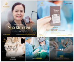 MẤT MỘT RĂNG - CẤY IMPLANT SỚM ĐỂ GIỮ CẢ HÀM RĂNG CHẮC KHỎE