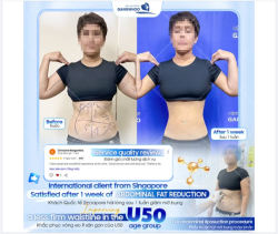 Ở độ tuổi U50, cơ thể bắt đầu có những thay đổi tự nhiên, đặc biệt là vùng bụng.