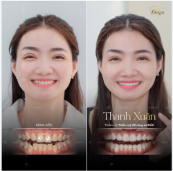 HÀNH TRÌNH NỤ CƯỜI BẮT ĐẦU TỪ NIỀM TIN TUYỆT ĐỐI