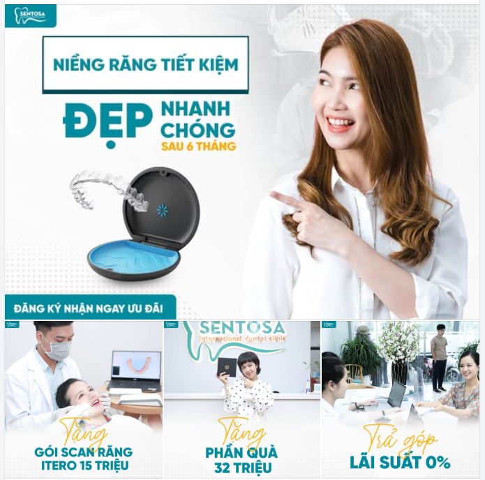 NIỀNG RĂNG TIẾT KIỆM – ĐẸP NHANH CHÓNG SAU 6 THÁNG