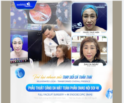 Tuổi tác, áp lực cuộc sống, thời gian…khiến làn da dần chùng nhão, nếp nhăn hằn sâu, gương mặt mất đi sự tươi tắn vốn có.