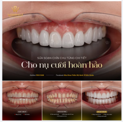 SỬA SOẠN CHỈN CHU TỪNG CHI TIẾT CHO NỤ CƯỜI HOÀN HẢO