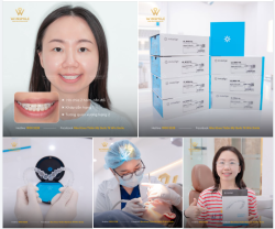 CÓ NHỮNG NỤ CƯỜI PHẢI ĐI THÊM MỘT HÀNH TRÌNH MỚI TRỞ NÊN TRỌN VẸN