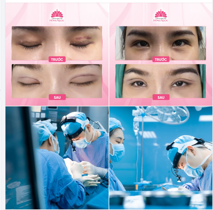 SỬA MÍ HỎNG SAU 10 NGÀY NHẤN MÍ: LẤY LẠI NẾP MÍ ĐẸP TỰ NHIÊN CHỈ SAU 45P