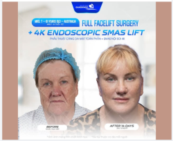 Ở tuổi 61, Mrs.T bắt đầu cảm nhận rõ những dấu hiệu của thời gian: