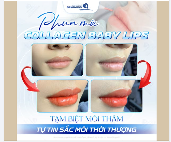 TẠM BIỆT MÔI THÂM – TỰ TIN SẮC MÔI THỜI THƯỢNG