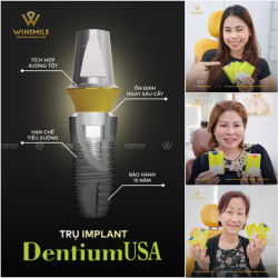 TRỤ IMPLANT DENTIUM USA - TÍNH ỔN ĐỊNH CAO, BẢO TỒN XƯƠNG LÂU DÀI