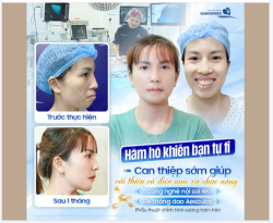 CAN THIỆP SỚM GIÚP BẠN CẢI THIỆN DIỆN MẠO VÀ CHỨC NĂNG
