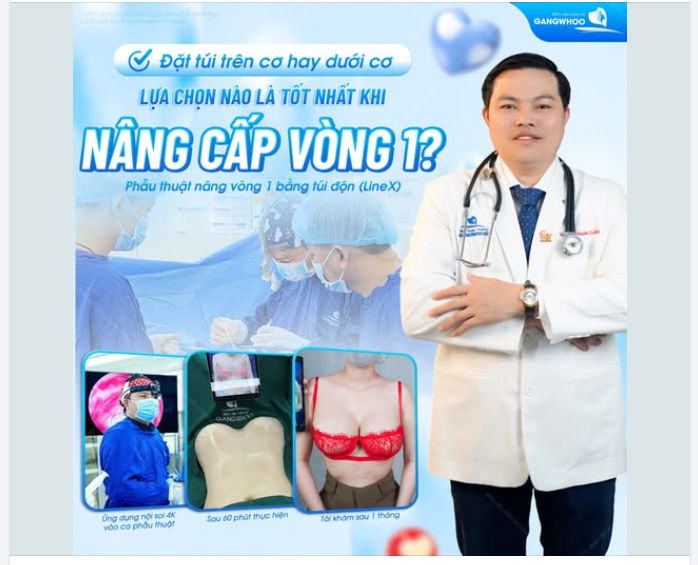 ĐẶT TÚI TRÊN CƠ HAY DƯỚI CƠ - LỰA CHỌN NÀO LÀ TỐT NHẤT KHI NÂNG CẤP VÒNG 1?