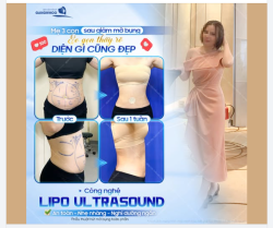 EO GỌN DIỆN ĐỒ DỄ DÀNG HƠN