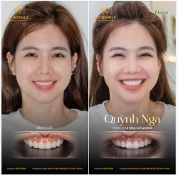 SỰ TỰ TIN ĐẾN NHỮNG THAY ĐỔI NHỎ BÊN TRONG