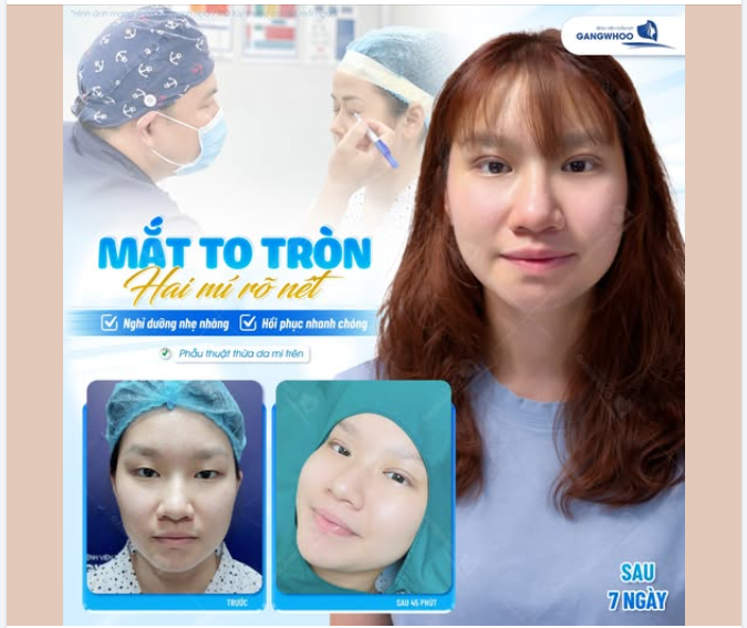 MẮT TO TRÒN, HAI MÍ RÕ NÉT