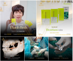 MẤT RĂNG CÀNG LÂU, TIẾN TRÌNH ĐIỀU TRỊ CÀNG PHỨC TẠP