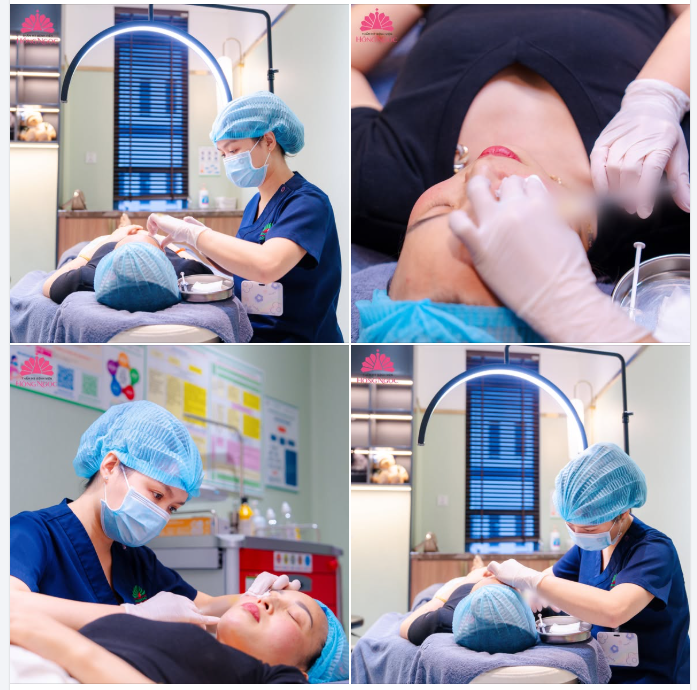 CHĂM DA ĐÓN LỄ: TẠM BIỆT NÁM SẠM - ĐÓN LÀN DA SÁNG KHỎE, ĐỀU MÀU NHỜ TIÊM MESO