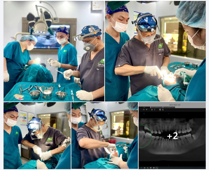 Nhổ răng khôn không đơn thuần là một thủ thuật – đó là cả một quy trình chuẩn y khoa được cá nhân hóa cho từng khách hàng.