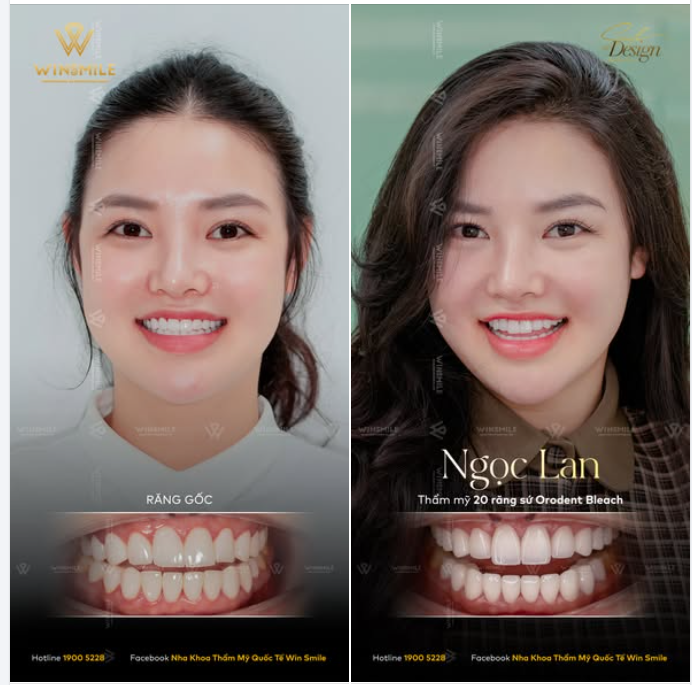 Nụ cười vốn dĩ là món trang sức đắt giá nhất của người phụ nữ, nhưng với Ngọc Lan, món trang sức ấy lại trông kém sắc bởi lựa chọn chưa xứng tầm