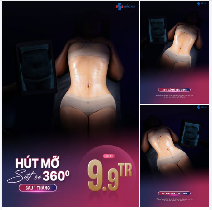 1 THÁNG SAU HÚT MỠ SIẾT EO 360 – SỰ THAY ĐỔI RÕ RỆT TRONG TỪNG ĐƯỜNG NÉT