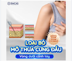 ĐÁNH BAY MỠ CỨNG ĐẦU VỚI CÔNG NGHỆ BODYTITE