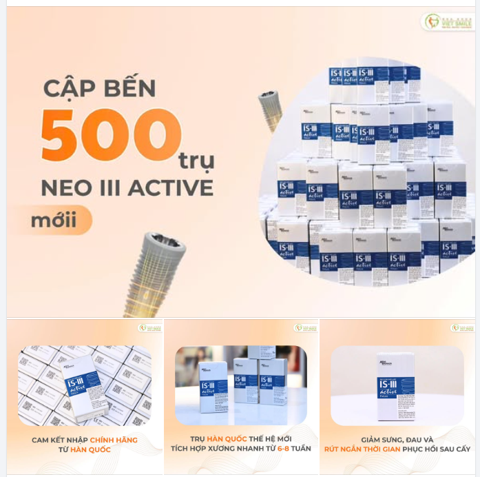 500 TRỤ IMPLANT NEO BIOTECH IS III ACTIVE – SẴN SÀNG CHO NHỮNG NỤ CƯỜI MỚI