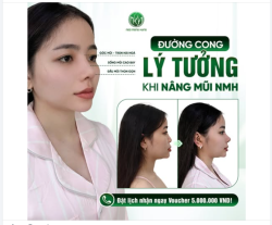 Đường cong lý tưởng khi nâng mũi tại Bệnh Viện PTTM Ngô Mộng Hùng!