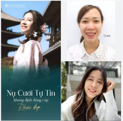 TỪ CÔ GÁI KHÉP MÌNH ĐẾN NỤ CƯỜI TỎA SÁNG MỌI KHUNG HÌNH