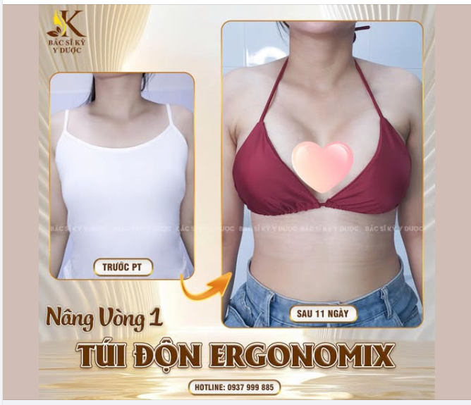 11 NGÀY THAY ĐỔI - VẺ ĐẸP TỰ NHIÊN NHƯ THẬT