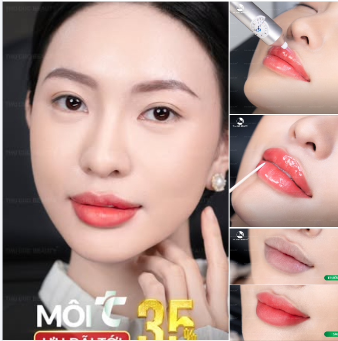 RẠNG RỠ MỌI LÚC – TỰ TIN MẶT MỘC CÙNG MÔI TC