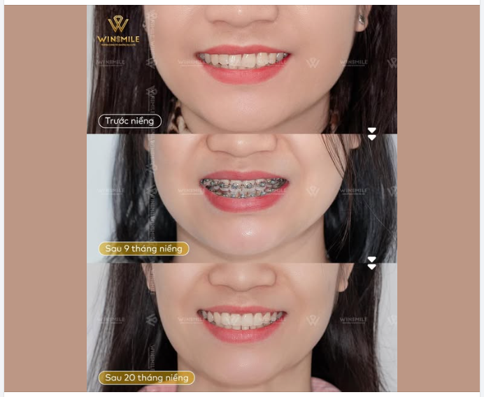 NỤ CƯỜI Ở ĐỘ TUỔI NÀO CŨNG SẴN SÀNG TỎA SÁNG