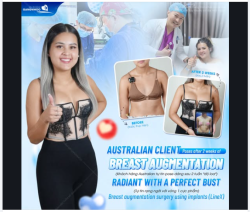 KHÁCH HÀNG AUSTRALIA TỰ TIN POSE DÁNG SAU 2 TUẦN “ĐỘ LOA” - TỰ TIN RẠNG NGỜI VỚI VÒNG 1 CỰC PHẨM