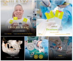 KHÔI PHỤC RĂNG HÀM BẰNG IMPLANT: GIẢI PHÁP BỀN VỮNG CHO KHẢ NĂNG ĂN NHAI LÂU DÀI