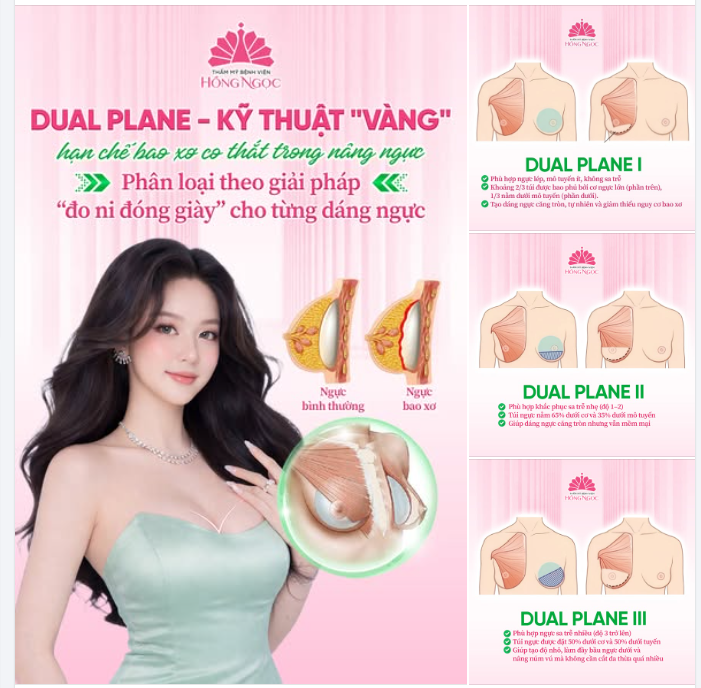 DUAL PLANE - “KỸ THUẬT VÀNG” GIÚP HẠN CHẾ BAO XƠ CO THẮT TRONG NÂNG NGỰC