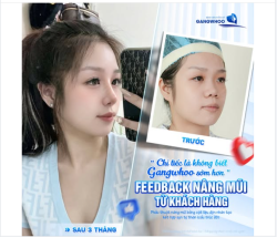 Nhiều chị em tâm sự với Gangwhoo rằng: "Chụp ảnh lúc nào cũng phải dùng app kéo mũi, quay góc nghiêng thì giấu vội vì mũi tẹt, đầu mũi thô..." - Bạn có thấy hình bóng mình trong đó?