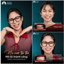 ĐỔI MỘT NỤ CƯỜI - LẤY SỰ TỰ TIN ĐỂ TRỞ THÀNH CA SĨ ️