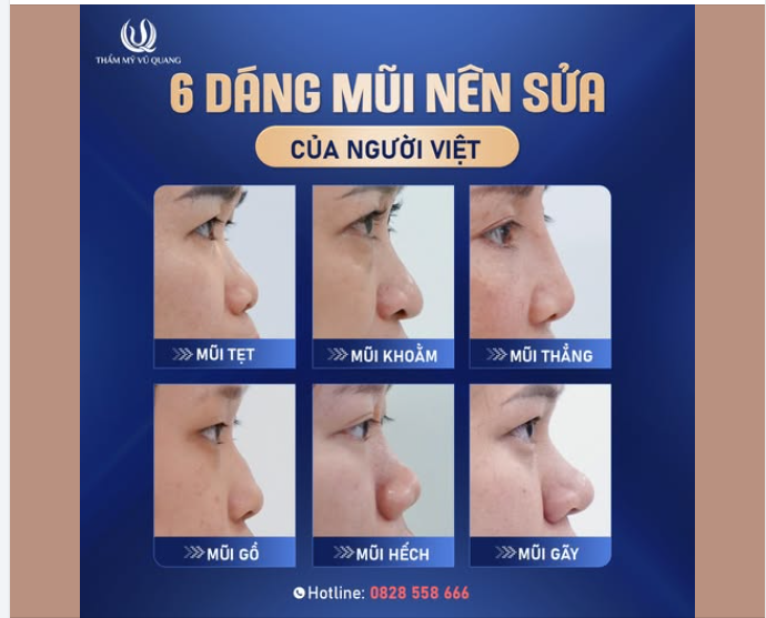 Bạn đang gặp vấn đề gì với dáng mũi hiện tại: