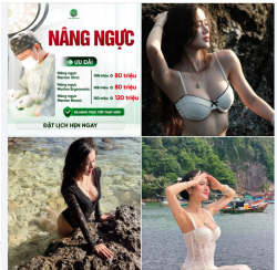 Ưu đãi đặc biệt cho 3 dòng túi ngực cao cấp nhất 2026!